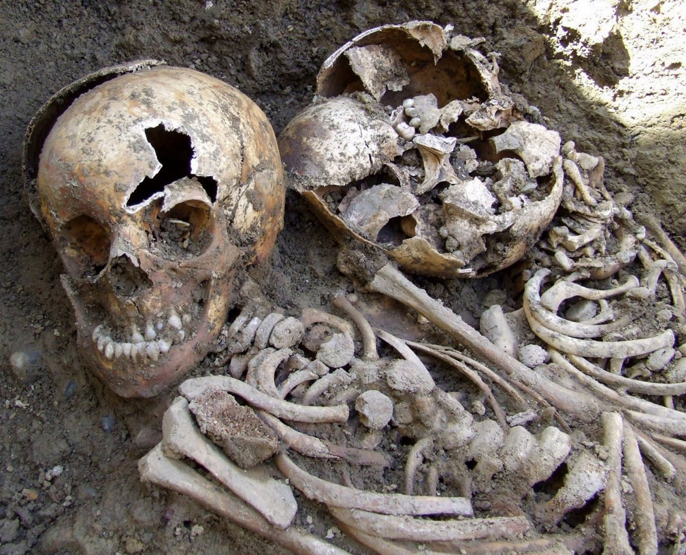 skeleton from famine grave